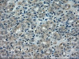 CRYAB Antibody in Immunohistochemistry (Paraffin) (IHC (P))