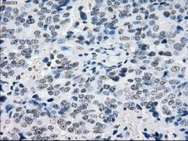 CRYAB Antibody in Immunohistochemistry (Paraffin) (IHC (P))