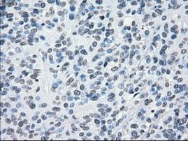 CRYAB Antibody in Immunohistochemistry (Paraffin) (IHC (P))