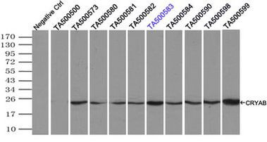 CRYAB Antibody in Immunoprecipitation (IP)