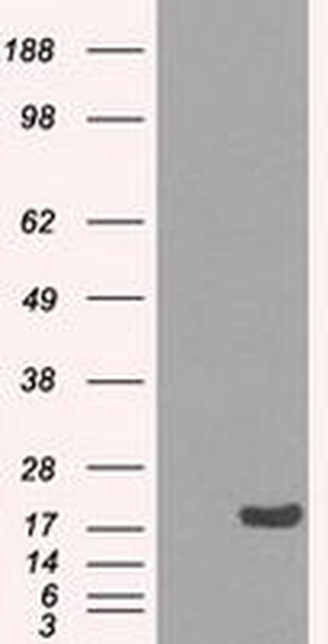 CRYAB Antibody in Western Blot (WB)