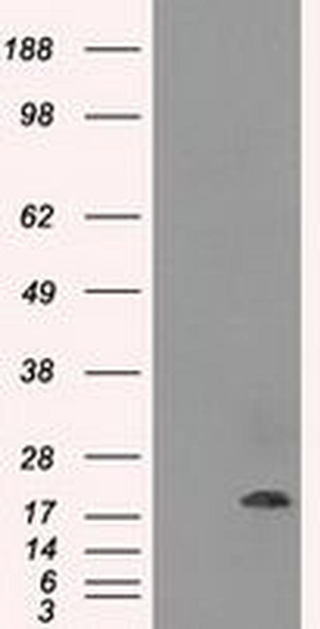 CRYAB Antibody in Western Blot (WB)