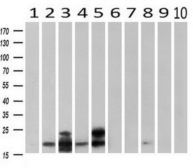 CRYAB Antibody in Western Blot (WB)