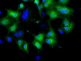 CRYM Antibody in Immunocytochemistry (ICC/IF)