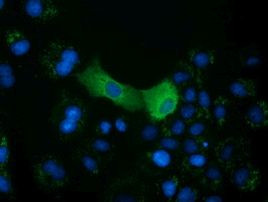 CRYM Antibody in Immunocytochemistry (ICC/IF)