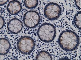 CRYM Antibody in Immunohistochemistry (Paraffin) (IHC (P))