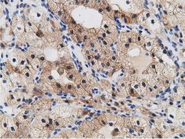 CRYM Antibody in Immunohistochemistry (Paraffin) (IHC (P))