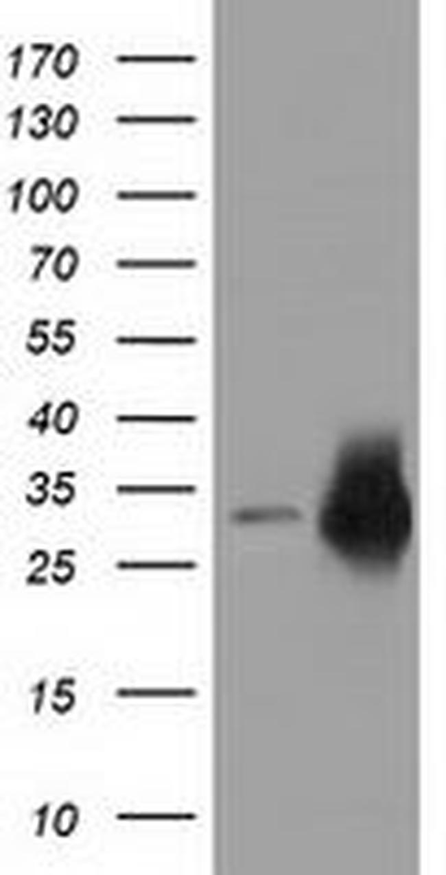 CRYM Antibody in Western Blot (WB)