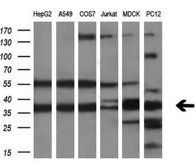 CRYM Antibody in Western Blot (WB)