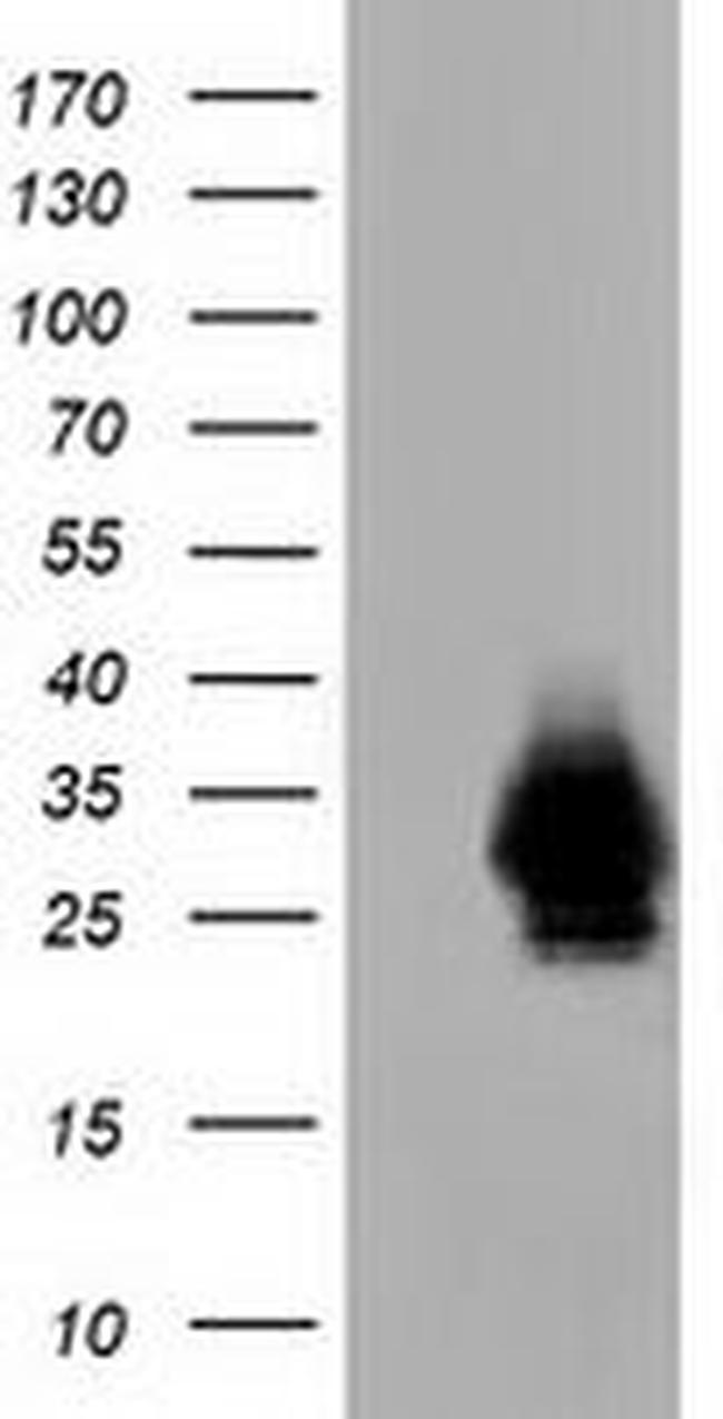 CRYM Antibody in Western Blot (WB)