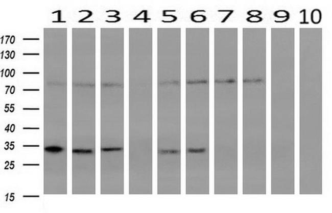 CRYM Antibody in Western Blot (WB)