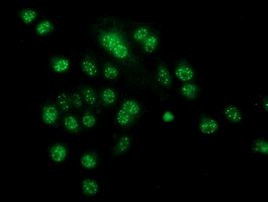 CRYZL1 Antibody in Immunocytochemistry (ICC/IF)