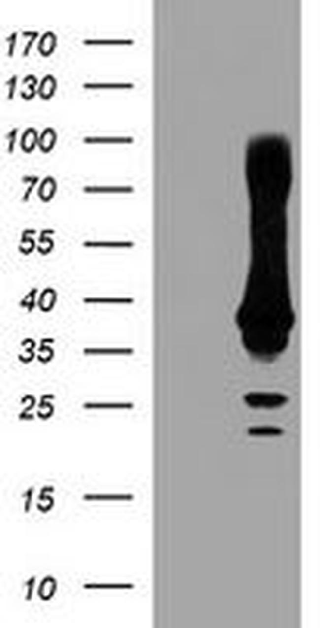 CRYZL1 Antibody in Western Blot (WB)