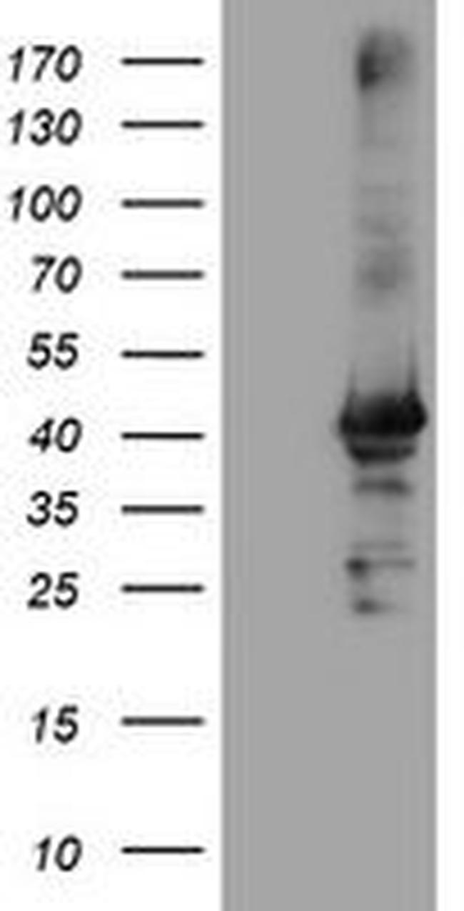 CRYZL1 Antibody in Western Blot (WB)