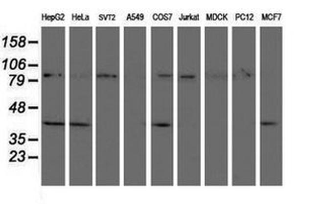 CRYZL1 Antibody in Western Blot (WB)