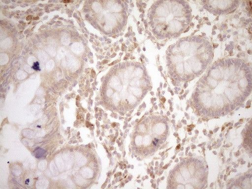 CSF1 Antibody in Immunohistochemistry (Paraffin) (IHC (P))