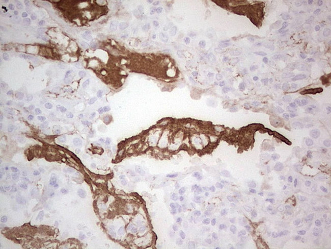 CSF1 Antibody in Immunohistochemistry (Paraffin) (IHC (P))