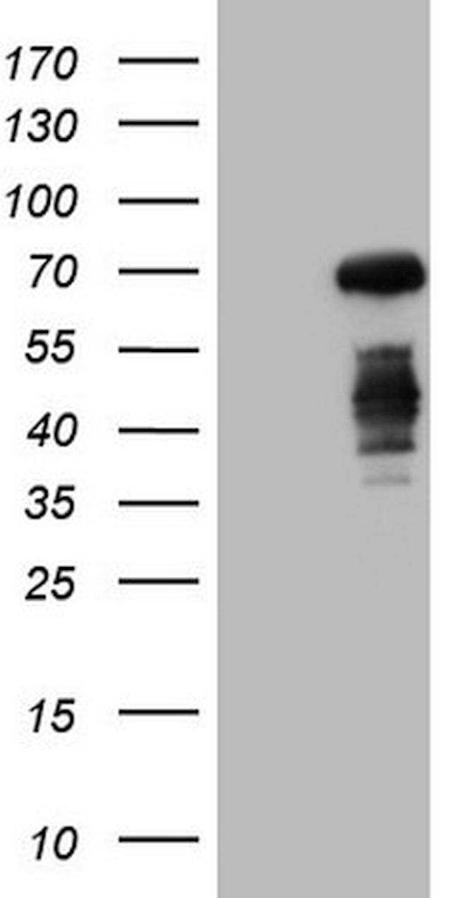 CSF1 Antibody in Western Blot (WB)