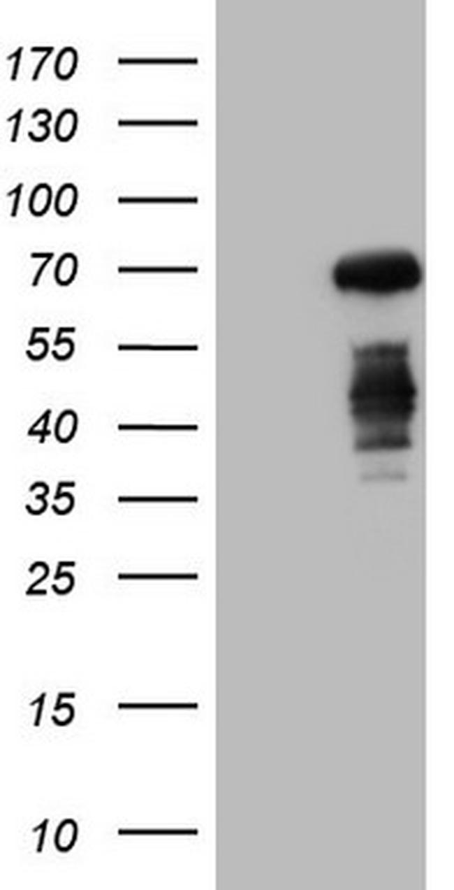 CSF1 Antibody in Western Blot (WB)