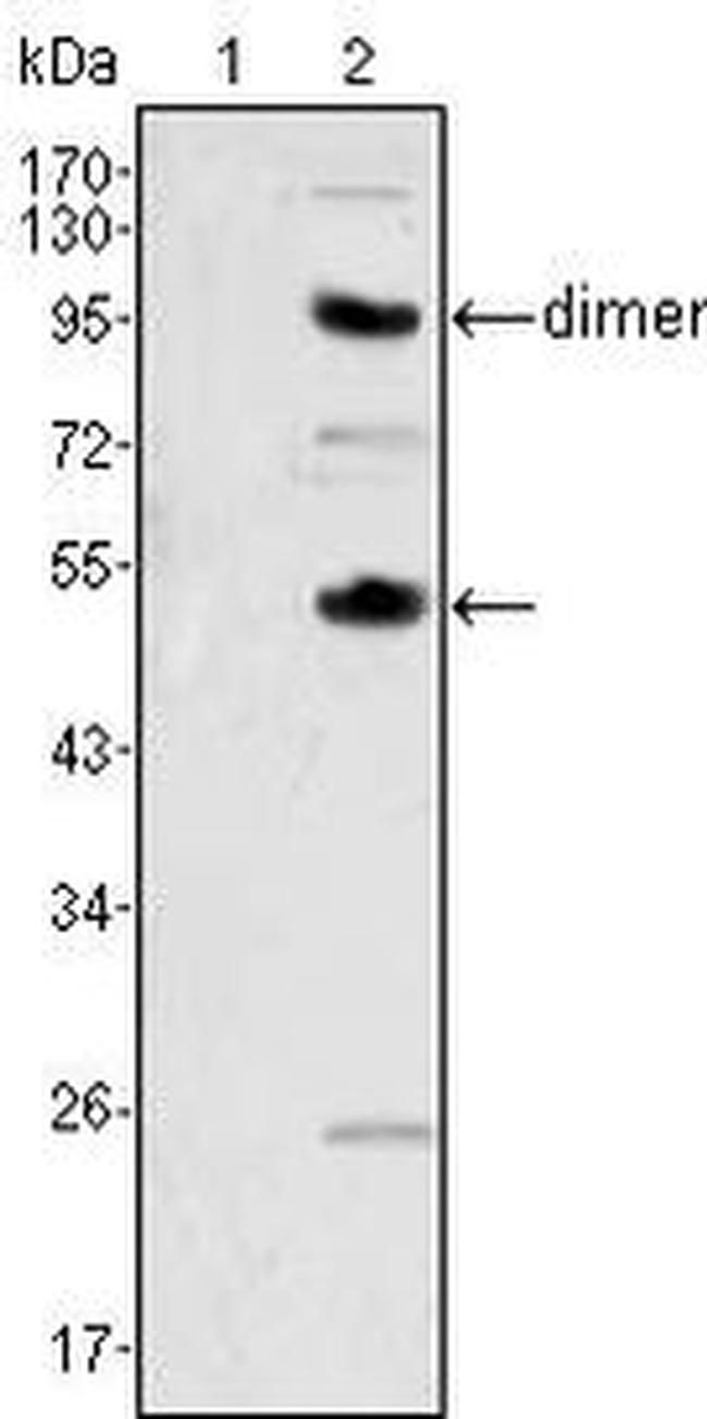 M-CSF Antibody in Western Blot (WB)