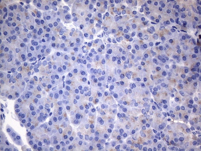 CSF2 Antibody in Immunohistochemistry (Paraffin) (IHC (P))