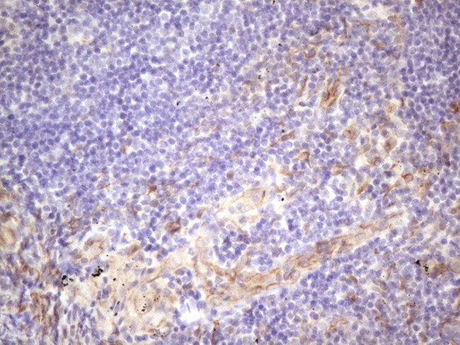 CSF2 Antibody in Immunohistochemistry (Paraffin) (IHC (P))