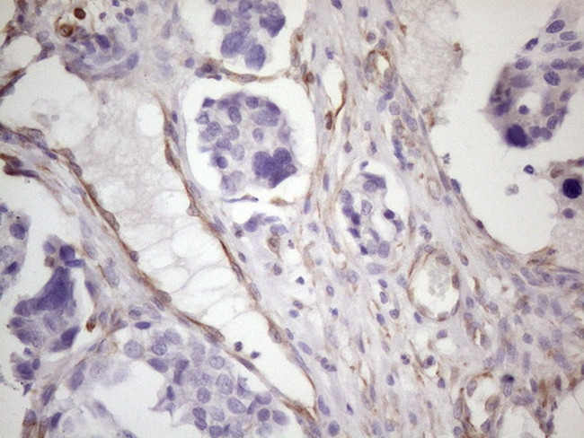 CSF2 Antibody in Immunohistochemistry (Paraffin) (IHC (P))