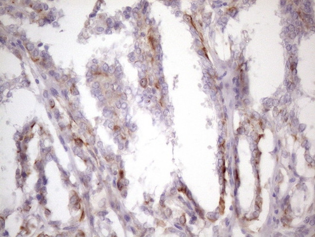 CSF2 Antibody in Immunohistochemistry (Paraffin) (IHC (P))