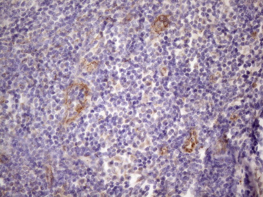 CSF2 Antibody in Immunohistochemistry (Paraffin) (IHC (P))