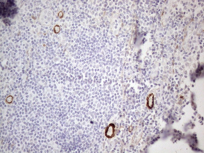 CSF2 Antibody in Immunohistochemistry (Paraffin) (IHC (P))