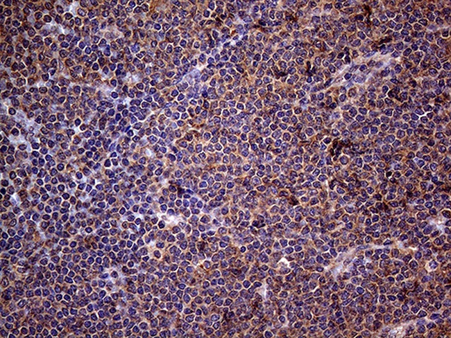 CSF2 Antibody in Immunohistochemistry (Paraffin) (IHC (P))