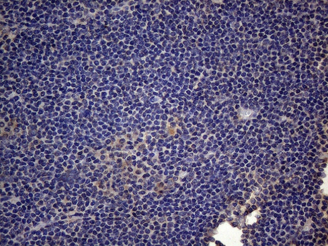 CSF2 Antibody in Immunohistochemistry (Paraffin) (IHC (P))