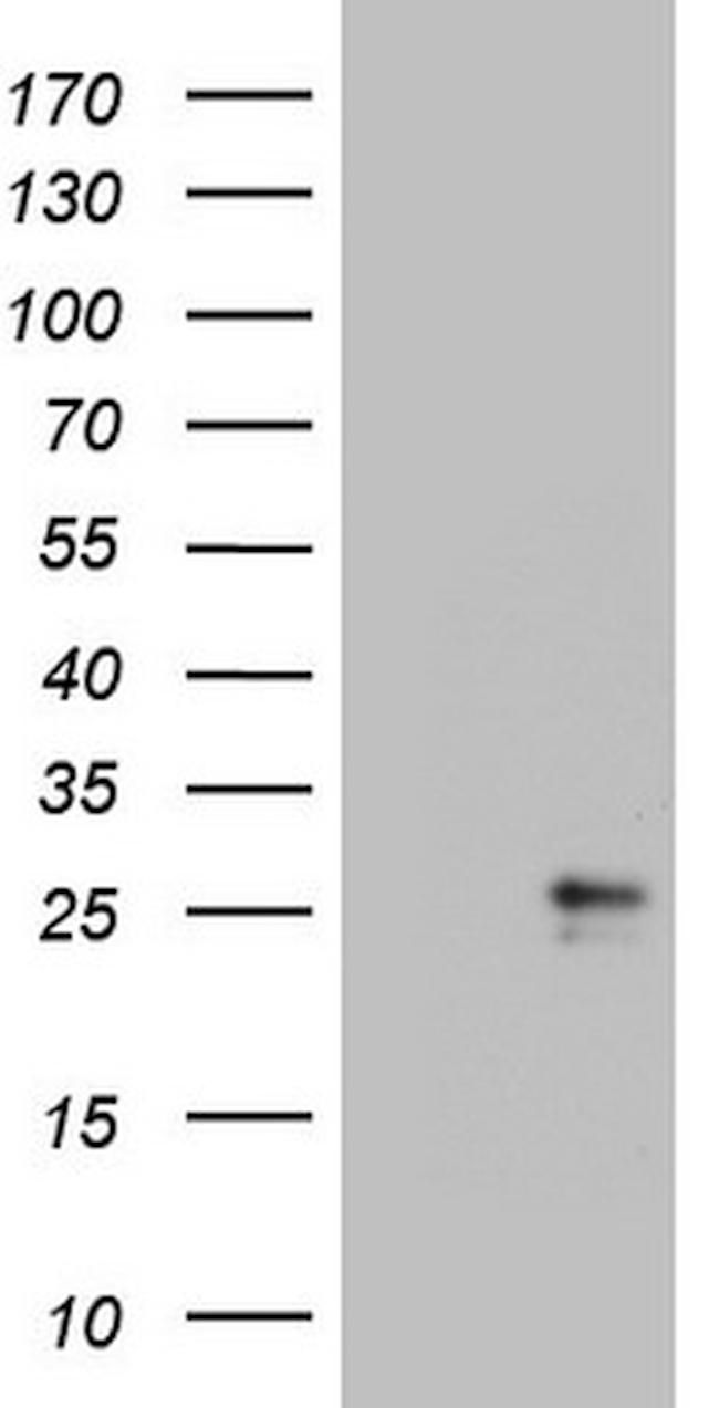 CSF2 Antibody in Western Blot (WB)