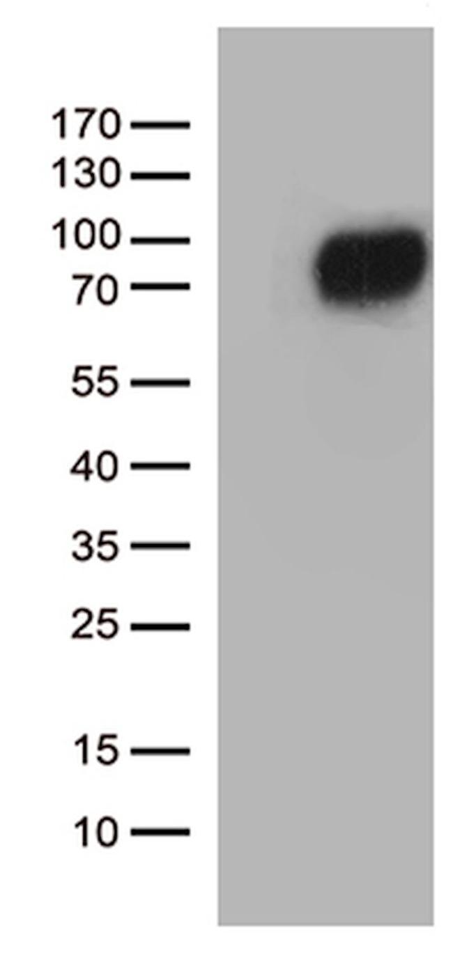 CSF2RA Antibody in Western Blot (WB)