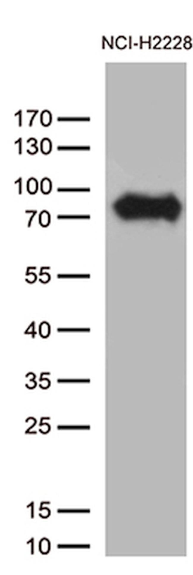 CSF2RA Antibody in Western Blot (WB)