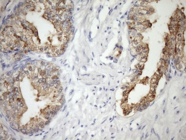 CSF2RB Antibody in Immunohistochemistry (Paraffin) (IHC (P))