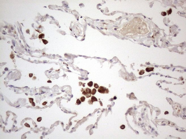 CSF2RB Antibody in Immunohistochemistry (Paraffin) (IHC (P))