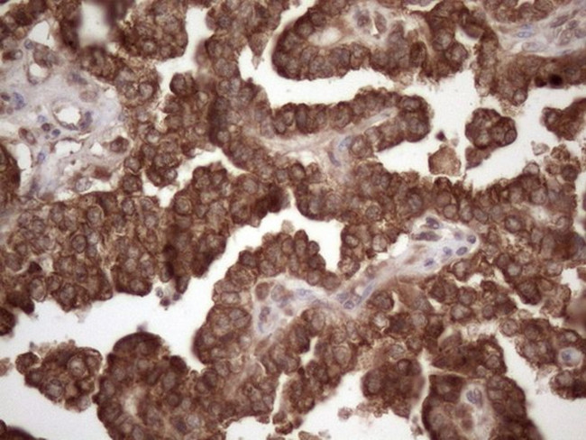 CSF2RB Antibody in Immunohistochemistry (Paraffin) (IHC (P))