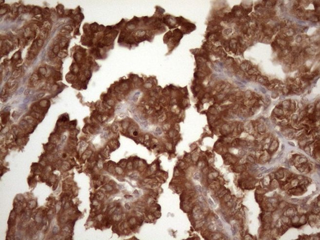 CSF2RB Antibody in Immunohistochemistry (Paraffin) (IHC (P))