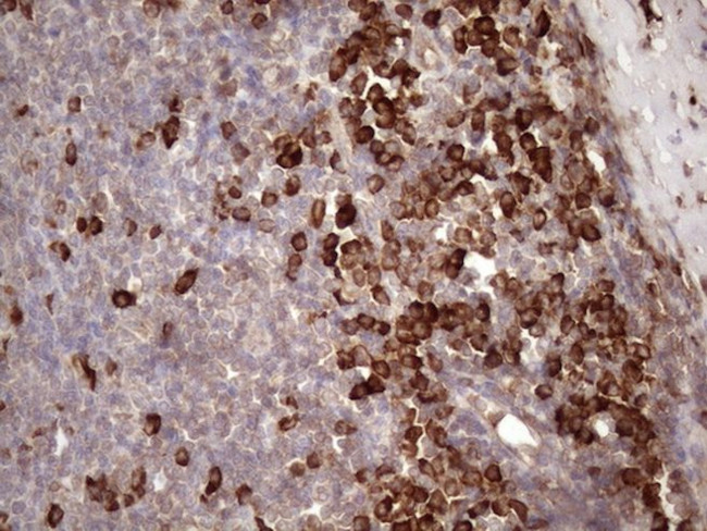 CSF2RB Antibody in Immunohistochemistry (Paraffin) (IHC (P))