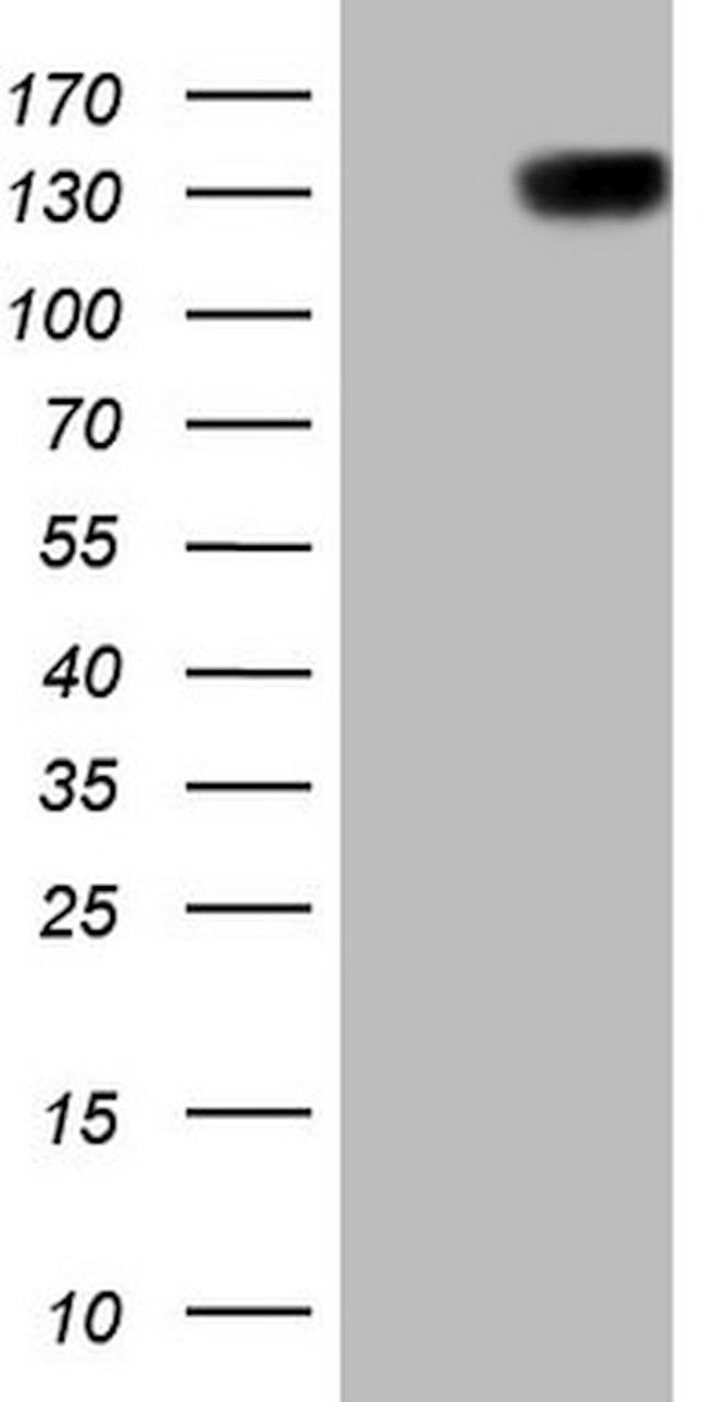 CSF2RB Antibody in Western Blot (WB)