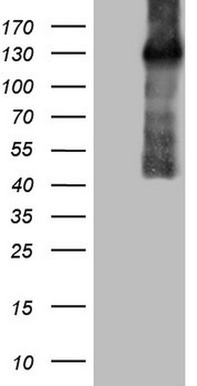 CSF2RB Antibody in Western Blot (WB)