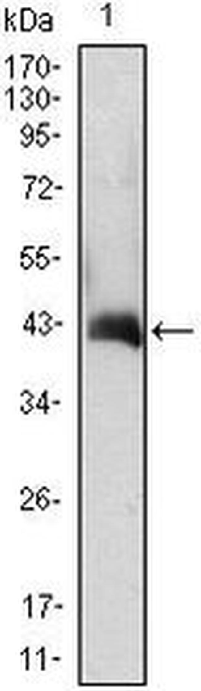 GM-CSF Antibody in Western Blot (WB)