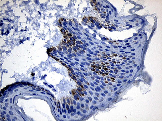 CSF3 Antibody in Immunohistochemistry (Paraffin) (IHC (P))