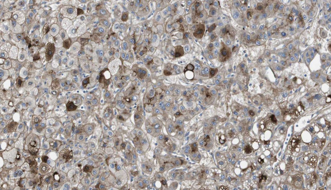 Vitronectin Antibody in Immunohistochemistry (Paraffin) (IHC (P))