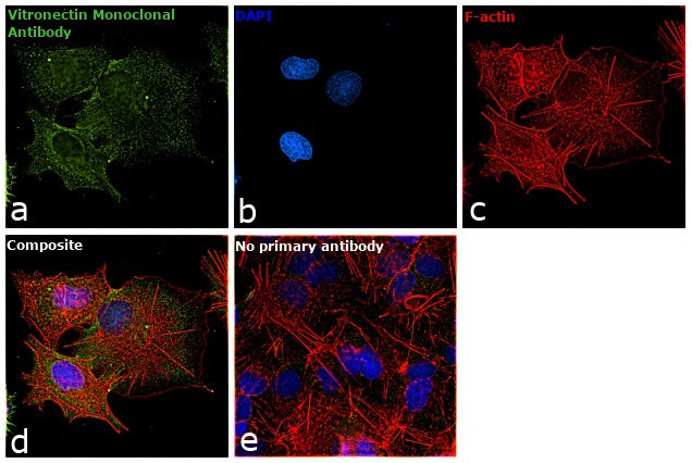 Vitronectin Antibody in Immunocytochemistry (ICC/IF)