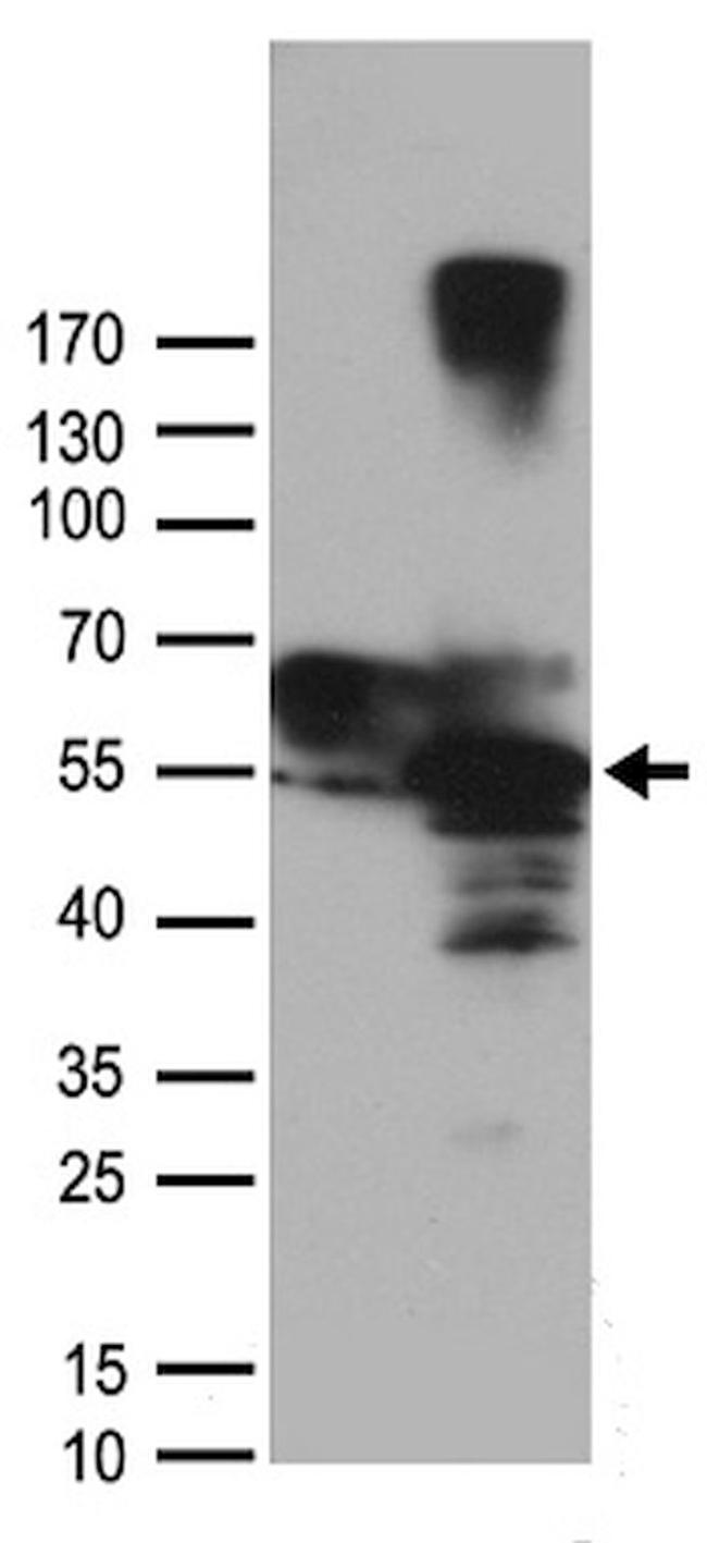 CSK Antibody in Western Blot (WB)