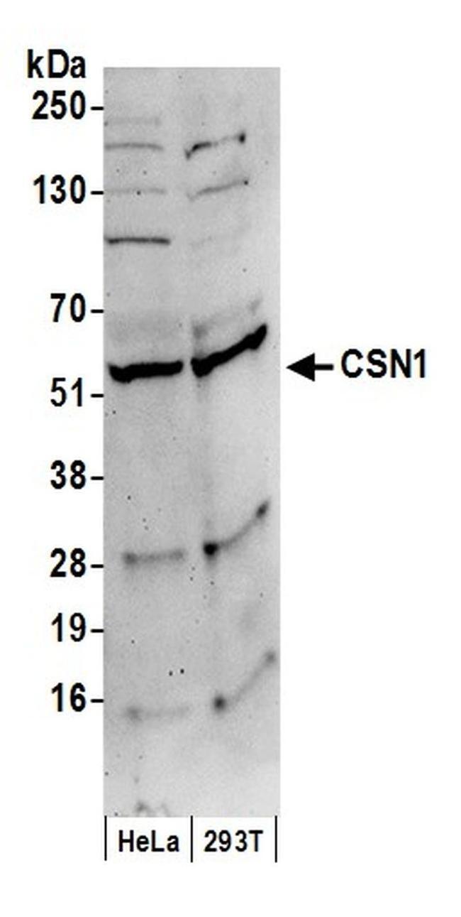 CSN1 Antibody in Western Blot (WB)