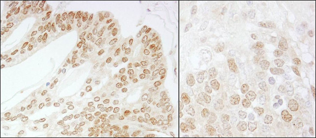 CSN5 Antibody in Immunohistochemistry (IHC)