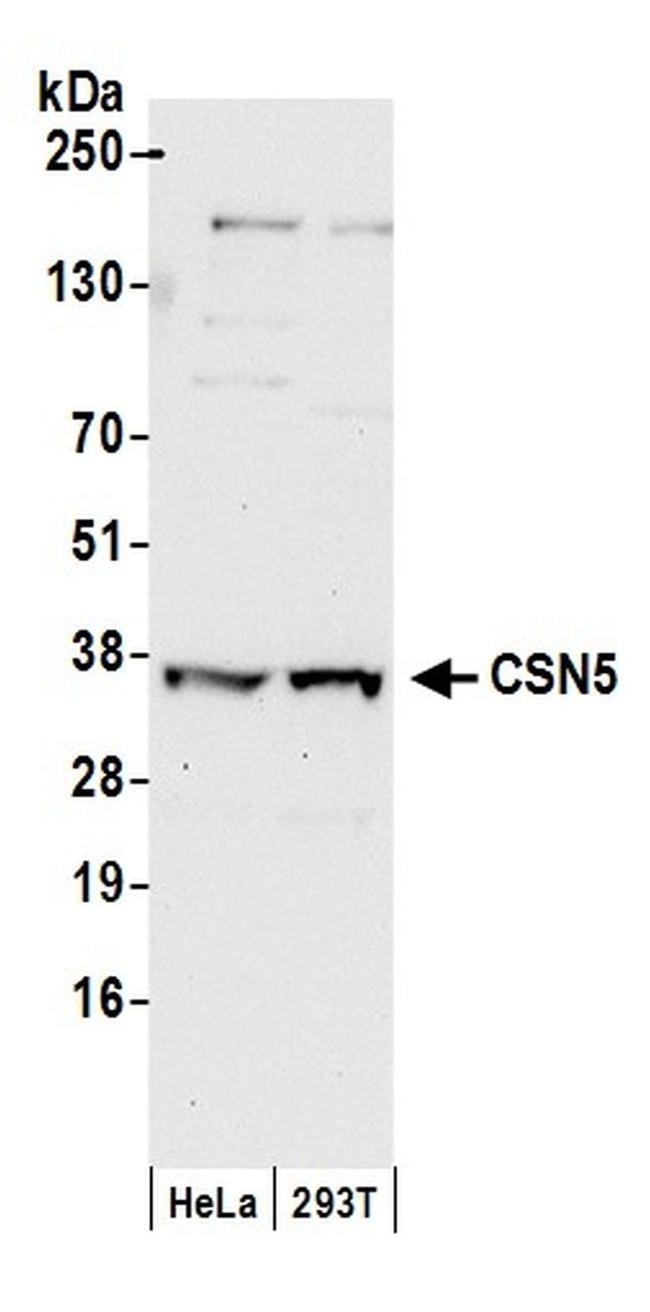 CSN5 Antibody in Western Blot (WB)